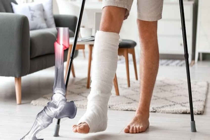 نهاية عصر الشرائح والمسامير المعدنية... الصين تبتكر غراء عظمي يصلح الكسور خلال دقائق ويذوب داخل الجسم