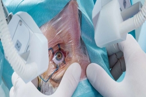 شبكة " غصن الزيتون "  بصفاقس.. حين يتحول العمل الجمعياتي إلى رافعة للحق في الصحة